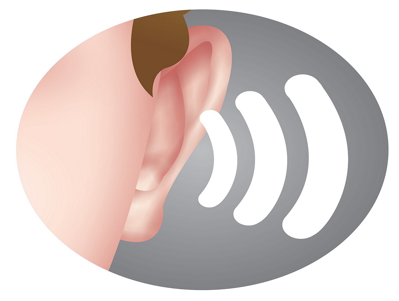 remboursement prothèse auditive