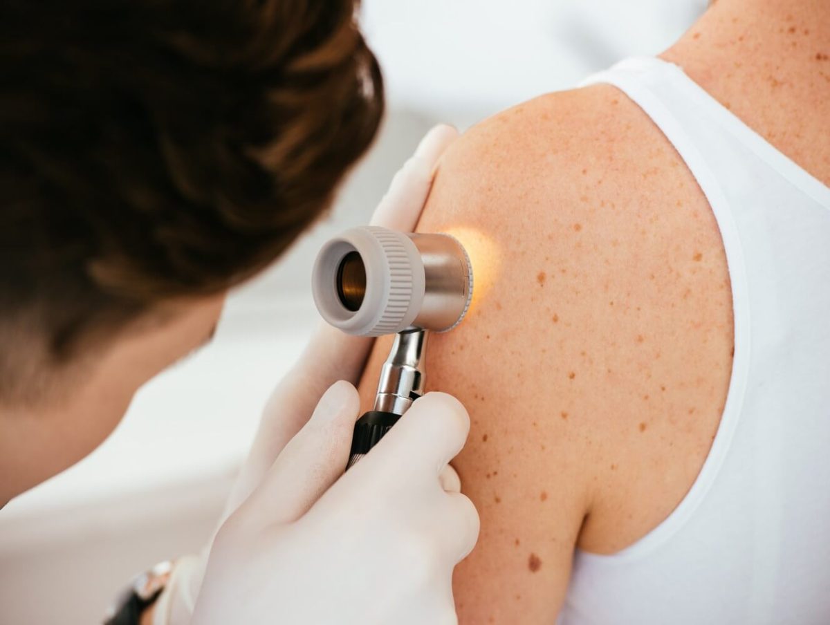 Remboursement dermatologue